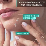 Uriage Hyséac Pâte SOS - Soin Local 15 g – Image 2